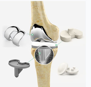 Femur-Patella Knieprothese 1
