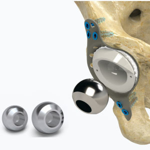 Hüftkopfprothese 1