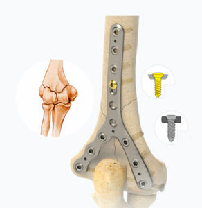 Kompressionsplatte für Humerus 1