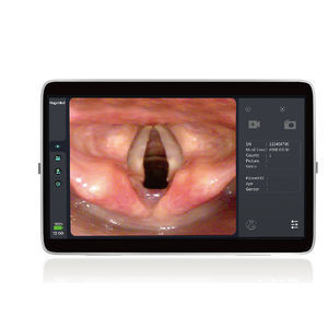 Videoprozessor für Endoskopie