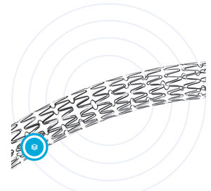Koronararterien-Stent 1