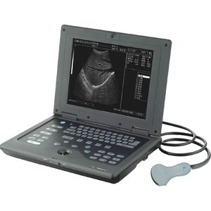 tragbares Ultraschallgerät