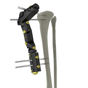 Fixateur externe / für Tibia 1