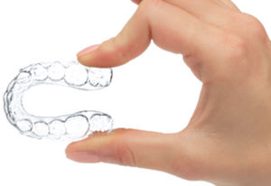 transparenter Aligner
