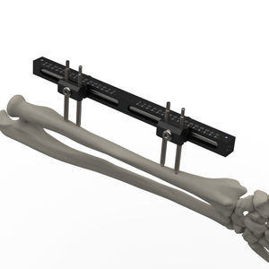 Fixateur externe / für Handgelenk