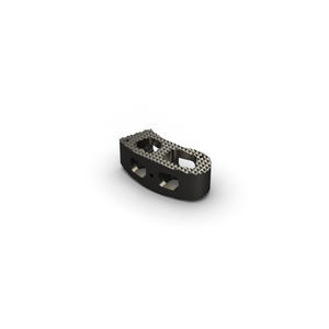 thorako-lumbales Zwischenwirbelimplantat
