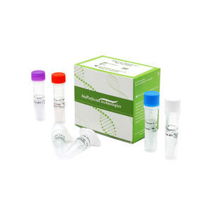 SARS-COV-2-Testkit