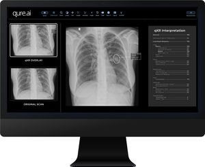 Software für Radiologie