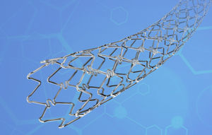 peripherer Stent