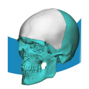 patientenspezifisches Schädelimplantat