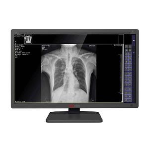 medizinisch Monitor
