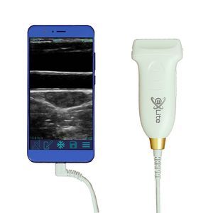 Tierärztliches Ultraschallsystem / Handgerät