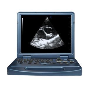 tragbares Tierärztliches Ultraschallsystem