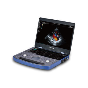 tragbares Tierärztliches Ultraschallsystem