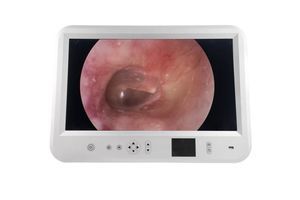 Endoskopisches Abbildungssystem / EUS