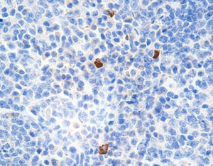 G4-Immunoglobuline-Reagenz