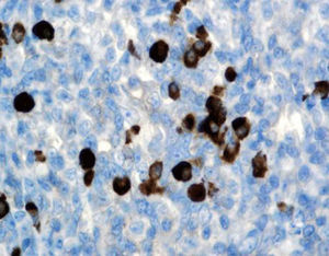 Reagenz / Immunglobulinklasse G
