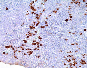 A-Immunoglobuline-Reagenz