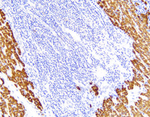 Antigen Reagenz