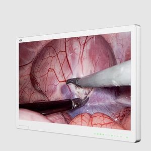 Monitor für Endoskopie