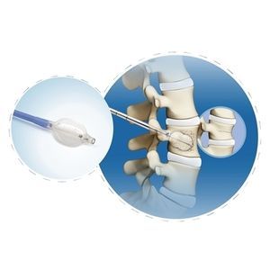 Instrumentenset / perkutane Kyphoplastie 1