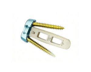 HWS-Zwischenwirbelimplantat 1