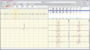 EEG-Software