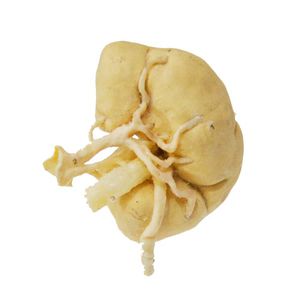 Anatomisches Modell / Niere 1