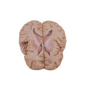anatomisches Gehirnmodell 1