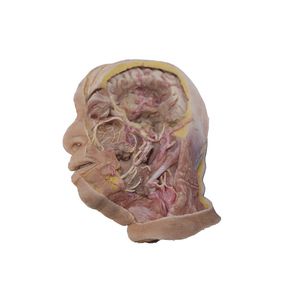 Anatomisches Modell / Kopf 1