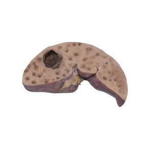 Anatomisches Modell / Leber 1