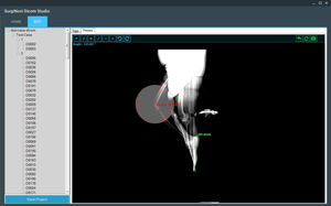 DICOM-Visualisierung-Software