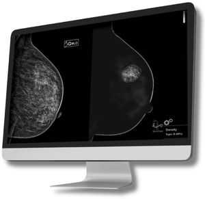 Computerprogramm für Mammographie-Tomosynthese