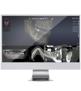 Chirurgisches Navigationssystem / für Zahnchirurgie