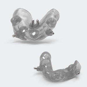 Chirurgische Schablone / Dental 1