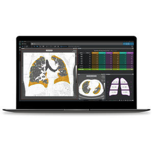Analysesoftware 1