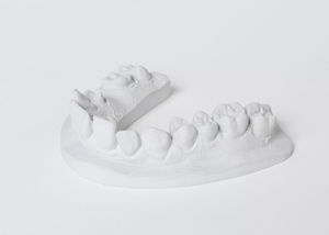 Zahnmedizinisches Material / Stein 1