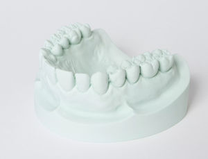 Zahnmedizinisches Material / Gips 1