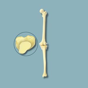 Anatomisches Modell / Knie 1