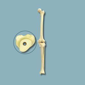 Anatomisches Modell / Knie 1