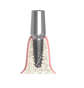 zylindrisches Implantat-Abutment