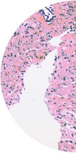 Testkit für Prostatakrebs