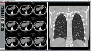 DICOM-Visualisierung-Software