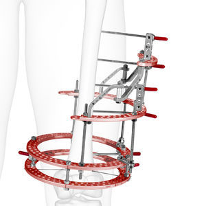 Fixateur externe / für Tibia 1