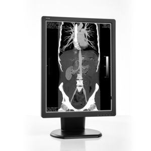 Diagnose-Monitor 1