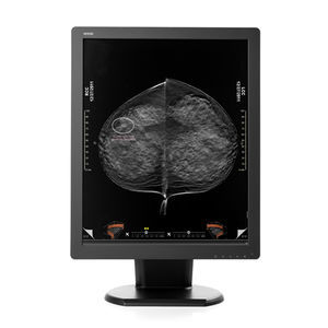 Diagnose-Monitor 1