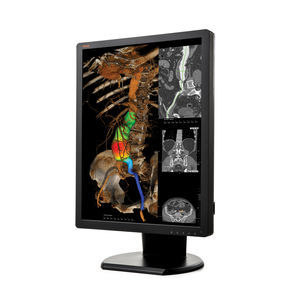 Diagnose-Monitor 1