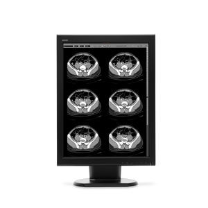 Diagnose-Monitor 1