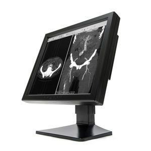 Diagnose-Monitor