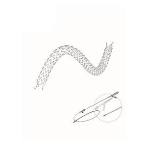 Ureter-Stent